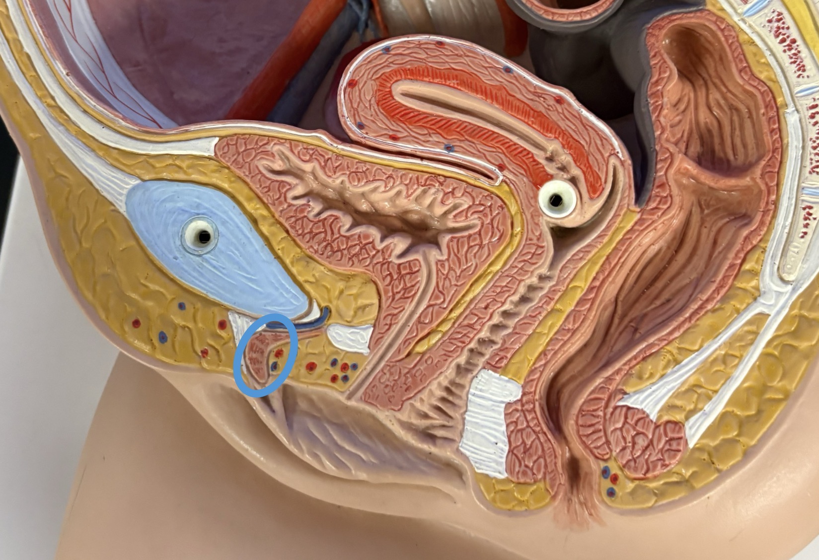 <p>erectile tissue contributing to female sexual arousal </p><ul><li><p>largely internal structure </p></li><li><p>anterior to urethra </p></li></ul><p></p>
