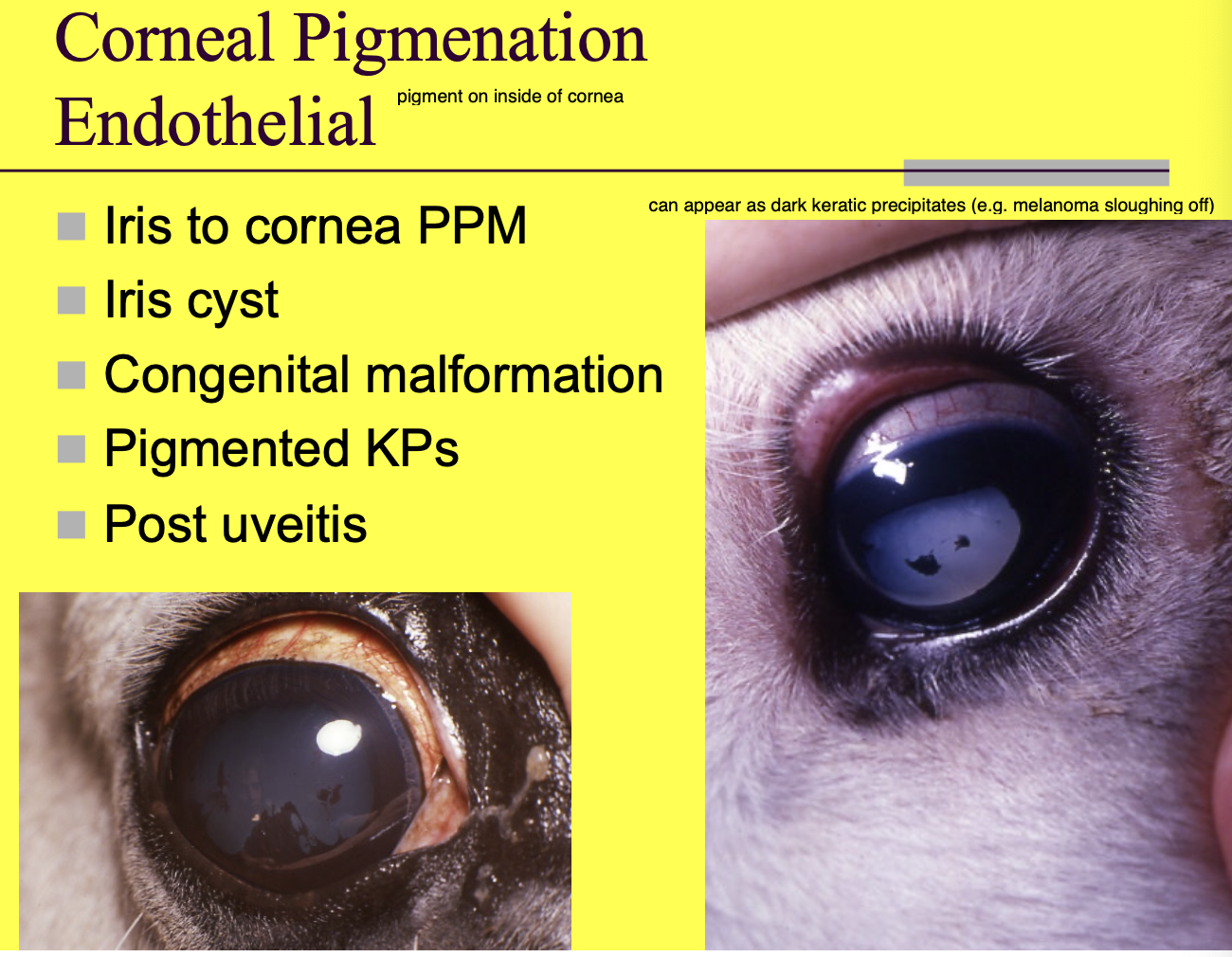 <p>Iris to cornea persistent pupillary membranes (PPM) (attach iris to inside of cornea).</p><p>Iris cysts (migrates from iris ands explodes on back of cornea).</p><p>Congenital malformation.</p><p>Pigmented KP (keratoprecipitates).</p><p>Post uveitis.</p>
