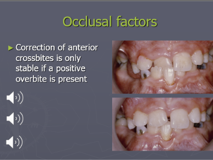 <ul><li><p>A positive overbite is present </p></li><li><p>mixed dentition, class 1 mal, ant cross bite ur1</p></li><li><p>labial migration of lr1 and gingival attachment loss and retention of labial surface of lr1 - warranting correction </p></li><li><p>URA is used to procline the ur1 over the 1 to correct the cross bite</p></li><li><p>because a good overbite is achieved after tx, the corrected malocclusion will be retained and remain stable as the overlap can prevent relapse </p></li></ul><p></p>