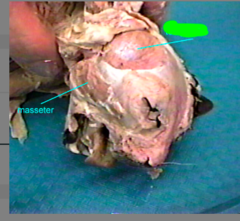 <p>muscle that acts with the masseter to elevate the mandible</p>