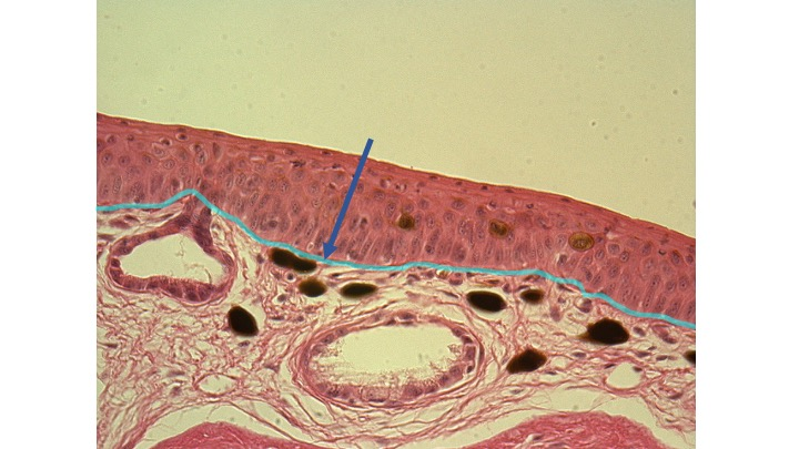 <p>Identify the structure highlighted on the image.</p>