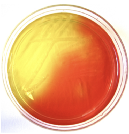<p><span>An unknown specimen was grown on Mannitol Salt agar (MSA). Observe the pictured result and answer the following question</span></p><p><span>select all appropriate statements regarding the <strong>pictured Mannitol Salt agar (MSA) test result.</strong></span></p><table style="min-width: 25px;"><colgroup><col style="min-width: 25px;"></colgroup><tbody><tr><td colspan="1" rowspan="1" style="margin: 0px; padding: 0.3em; position: relative;"><p>The organism tested is able to grow in the presence of high salt.</p></td></tr><tr><td colspan="1" rowspan="1" style="margin: 0px; padding: 0.3em; position: relative;"><p>The organism tested is most likely <em>Escherichia coli (E. coli)</em>.</p></td></tr><tr><td colspan="1" rowspan="1" style="margin: 0px; padding: 0.3em; position: relative;"><p>The organism tested is possibly a type of Staphylococci.</p></td></tr><tr><td colspan="1" rowspan="1" style="margin: 0px; padding: 0.3em; position: relative;"><p>The organism tested does not ferment mannitol.</p></td></tr><tr><td colspan="1" rowspan="1" style="margin: 0px; padding: 0.3em; position: relative;"><p>The organism tested ferments mannitol.</p></td></tr></tbody></table><p></p>