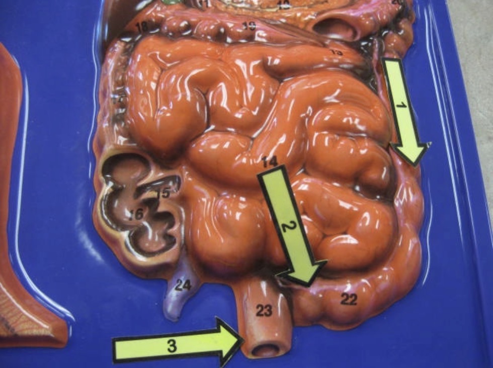 <p>Large intestine</p>