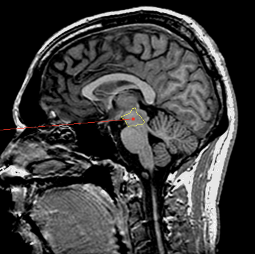 <p>What is the area highlighted called?</p>