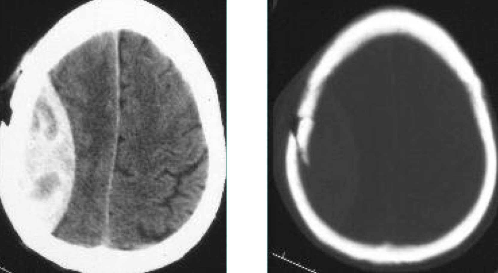 <p>What is this x-ray image of</p>