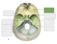 <p>Cranial fossa: this is the</p>