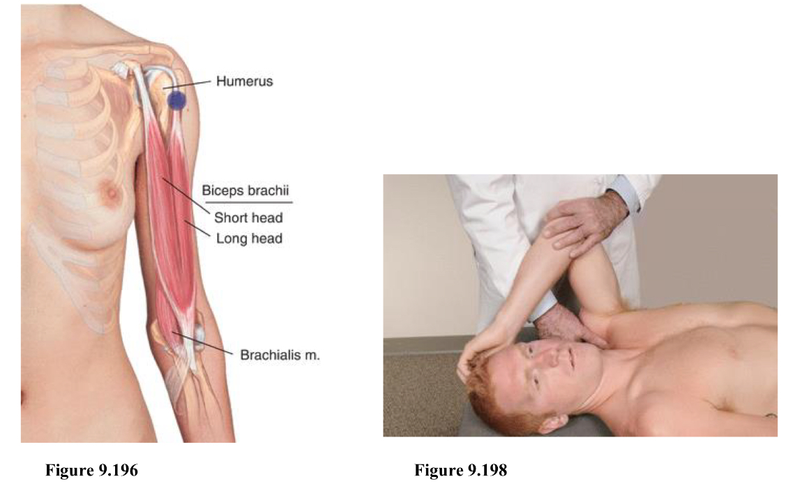 <p>F Abd IR</p><p>Location is over the tendon of the biceps muscle in the bicipital groove</p><ol><li><p>Pt supine</p></li><li><p>Physician sits or stands same side of point</p></li><li><p>Point is found at the bicipital groove (flex to feel for tendon)</p></li><li><p>Flex, abduct, and internally rotate (like you’re scratching head)</p></li></ol><p></p>