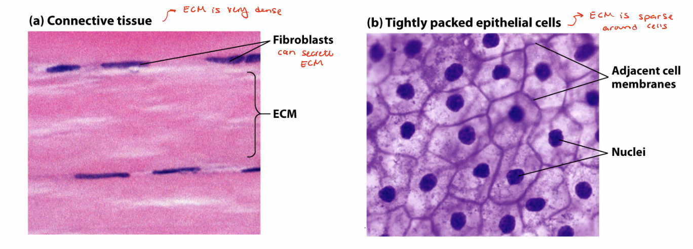 <ul><li><p><strong><em><u>dense connective tissue</u></em></strong> → contains mostly ECM containing tightly packed <span style="color: rgb(255, 164, 242);">ECM fibers</span> interspersed with rows of relatively sparse <span style="color: rgb(172, 58, 255);">fibroblasts</span> (cells that synthesized ECM) </p></li><li><p><strong><em><u>sparse connective tissue</u></em></strong> → squamous epithelial cells tightly packed into a quilt-like pattern with little ECM between the cells </p></li></ul><p></p>