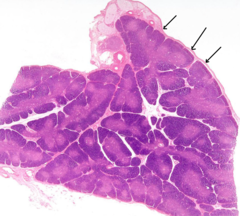 <p>What are the arrows pointing to in the thymus?</p>