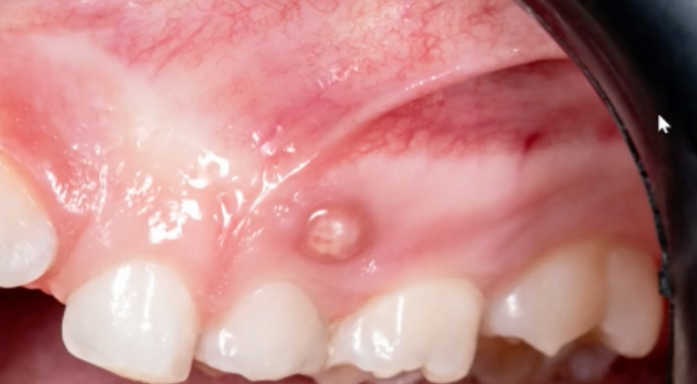 <p>after history and clinical exam, what is the next step? </p>