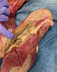 <p>Identify the muscle</p>