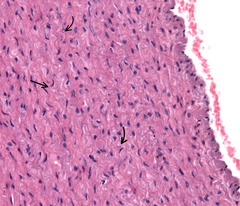 <p>What is indicated by the arrows in this layer of the aorta?</p>