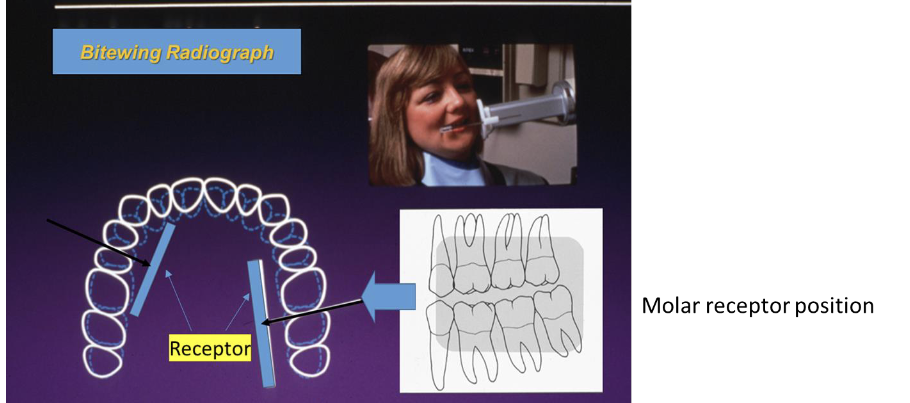 <p>- Anterior film/ receptor edge should be at the middle of lower canine or more anterior.</p><p>-Distal half of the canine to most of the first molar should be seen in the image.</p>