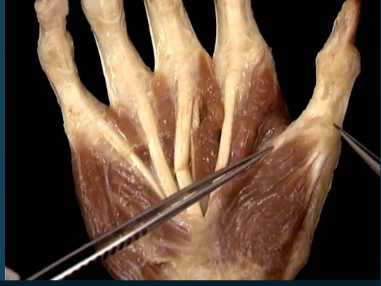 <p>Diep, Handpalm, pees van</p>