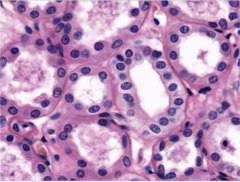 <p>Identify</p>