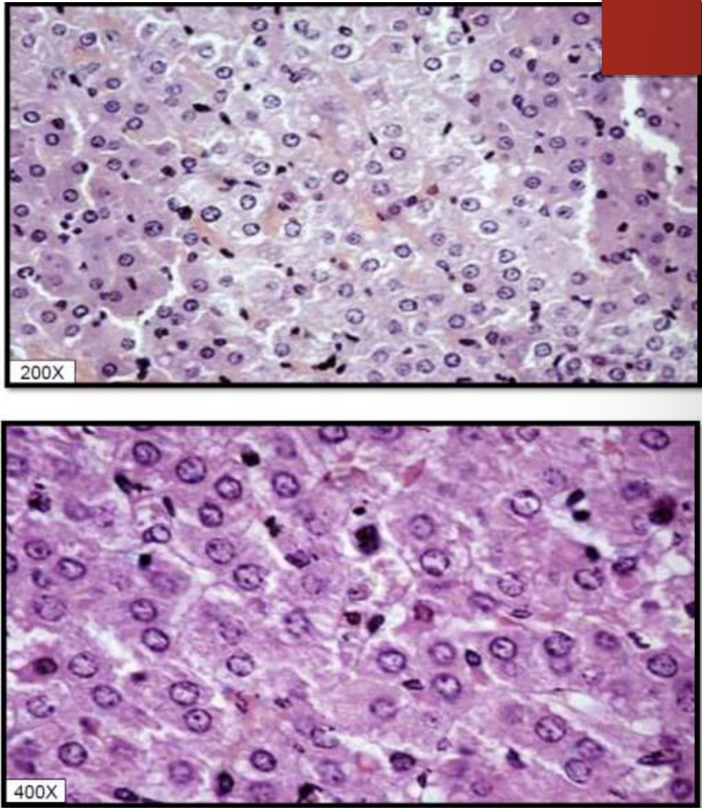 <p>What is the example given by the pictures?</p>