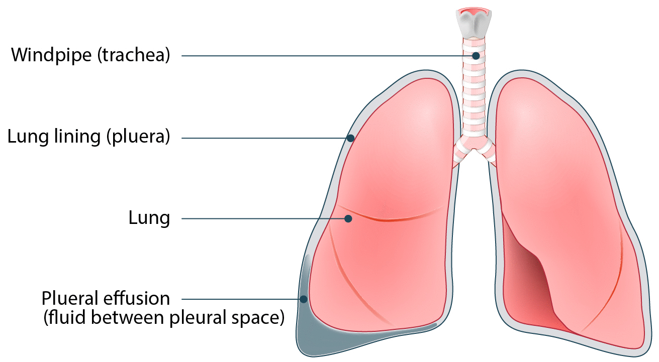 <p>Pleural Membranes</p>