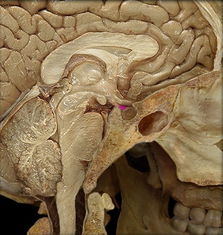 term image