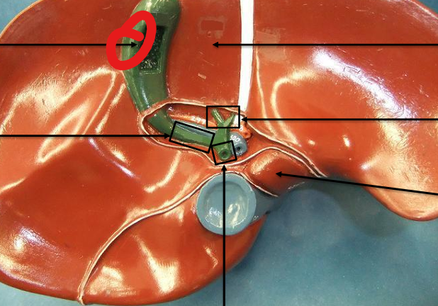 <p>what is this organ</p>