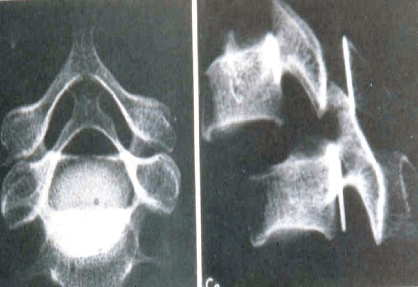 <p>What is the diagnosis?</p>