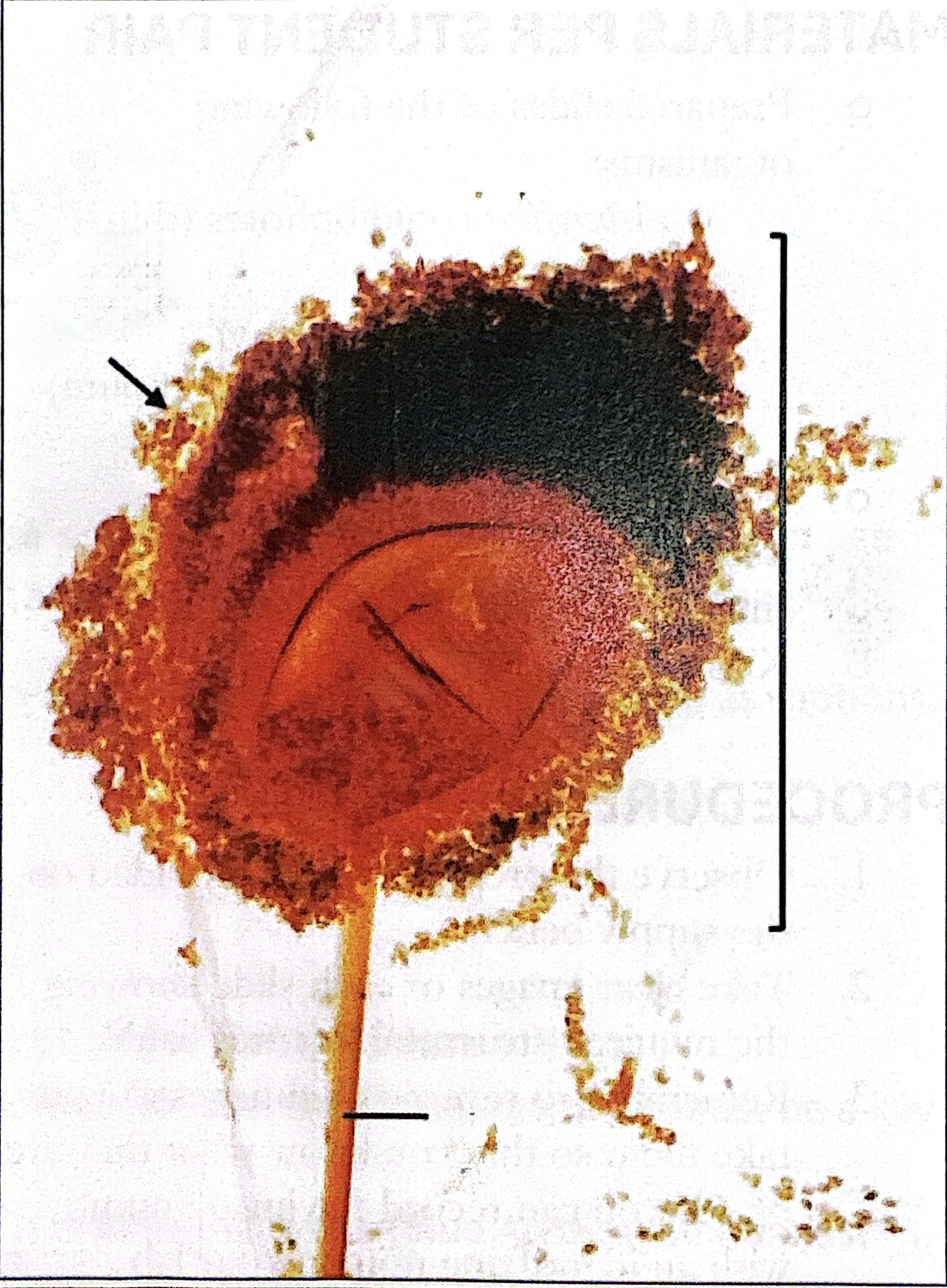 <p>Reproduces asexually with sporangiospore contained within sporangia formation</p>