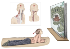 <p>Trapezius</p><p>activities like lifting your head up to watch a movie while in prone</p>