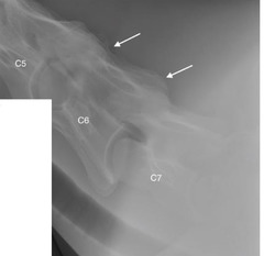 <p>A 17 year old thoroughbred gelding presents with a chronic bilateral front limb lameness and a 1 month history of progressive ataxia. Thoughts?</p>