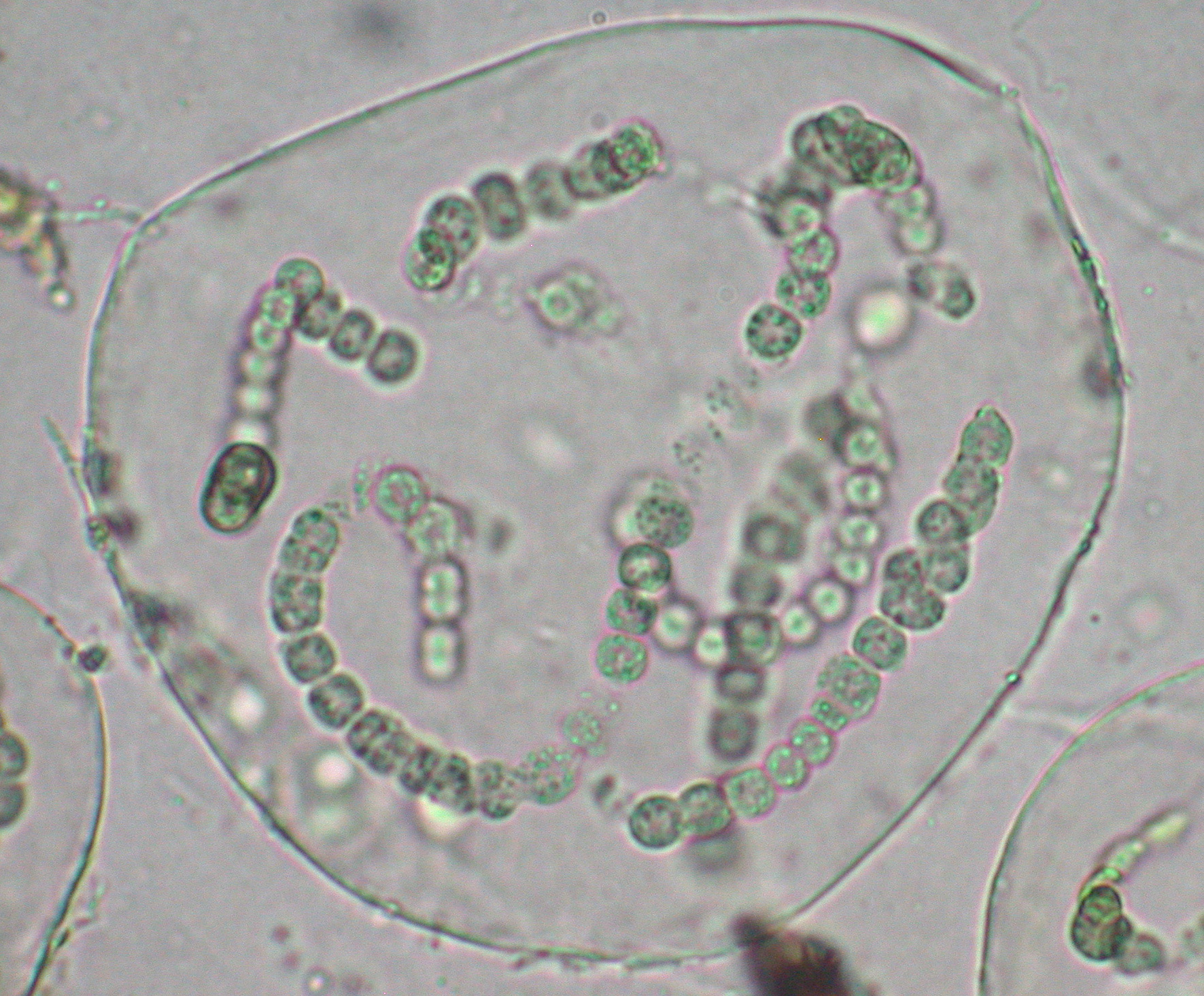 <ol><li><p>what is the phylum of this bacteria?</p></li><li><p>is it gram positive or gram negative?</p></li><li><p>what is the name of the specialized cell on the organism that fixates nitrogen?</p></li></ol><p></p>