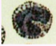 <p>What cell in the blood is shown?</p>