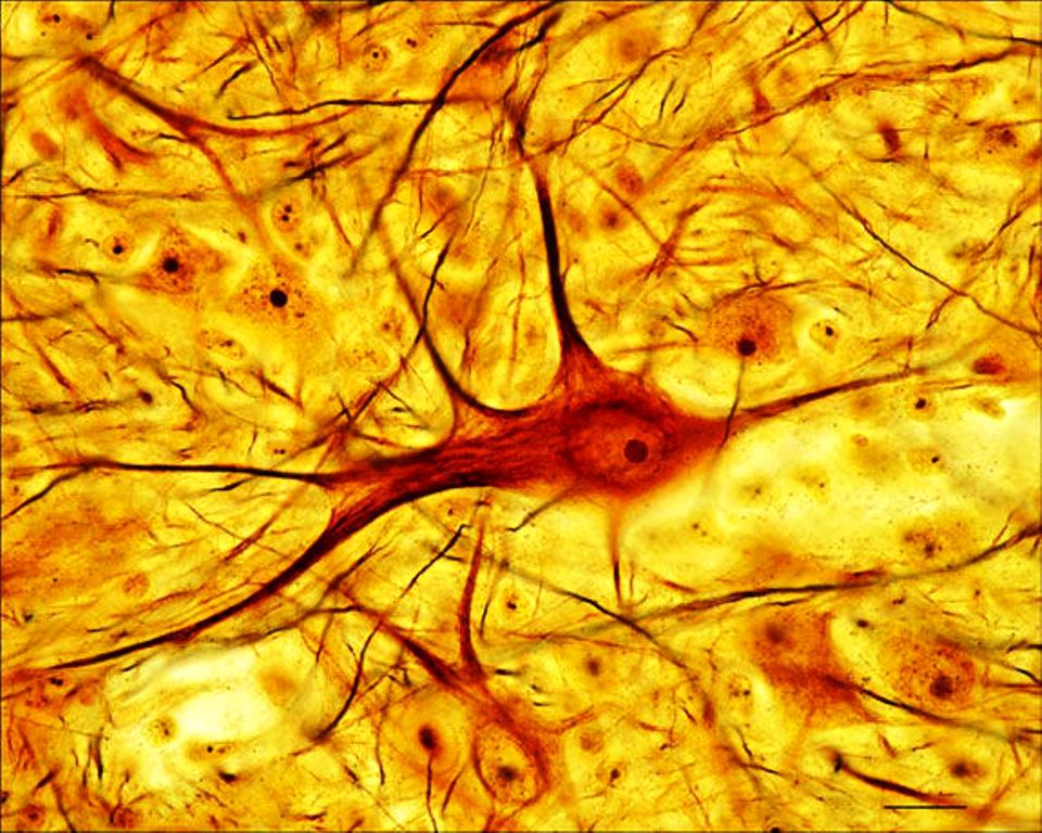 <p>Identifica la plaquita</p>