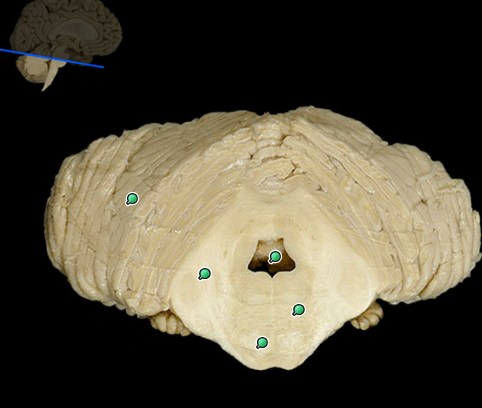 <p>Right and left cerebellar hemispheres</p>