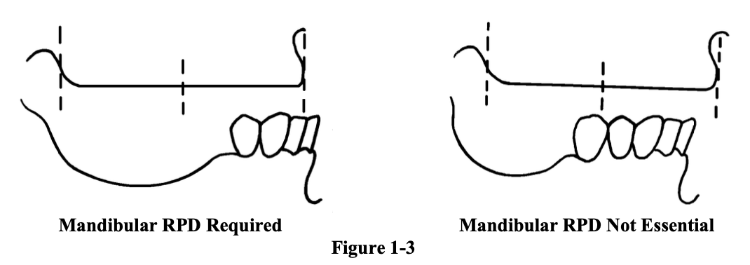 <p>Not every patient with missing mandibular posterior teeth absolutely needs an RPD. In which jaw relationship can patients manage nicely without an RPD?</p>