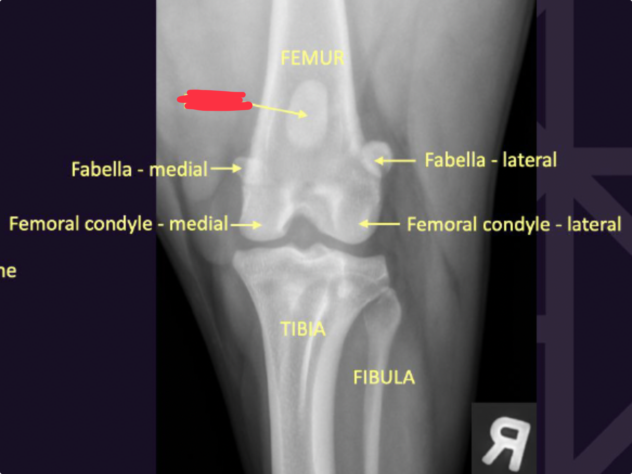 term image