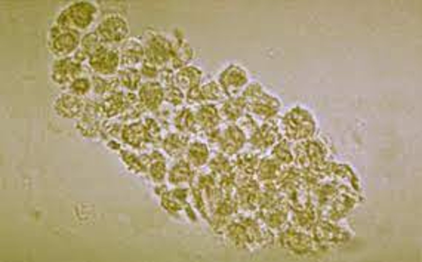<p>Pyelonephritis</p><p>A kidney infection is also called pyelonephritis. A kidney infection needs prompt medical treatment.</p>
