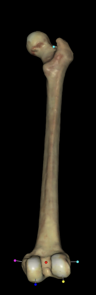 <p>what is the pink tag on the right femurs?</p>