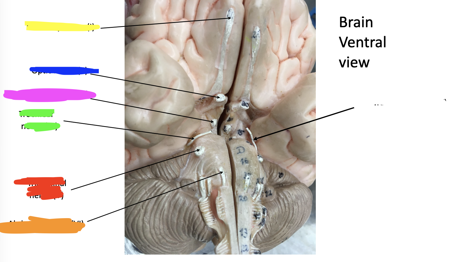 <p><span style="line-height: 19.425px;">Cranial nerves II - blue </span></p>