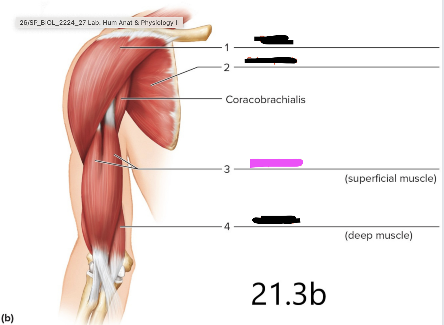 <p>Elbow - to move the forearm</p>