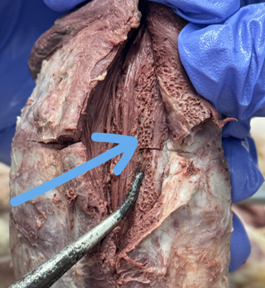 <p>spongy urethra</p>