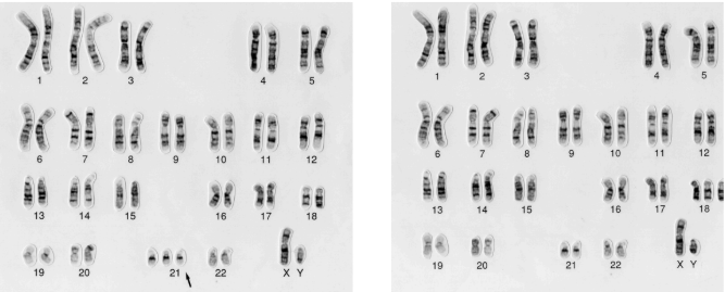 <p>is this is a normal karyotype? </p>