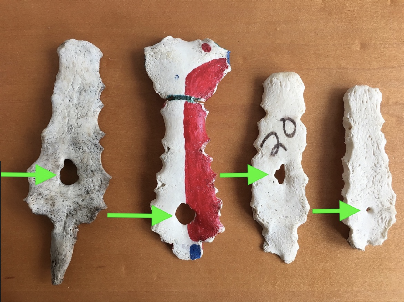 <p>Feature of the Sternum. High variation, and only present on some Sternums</p>