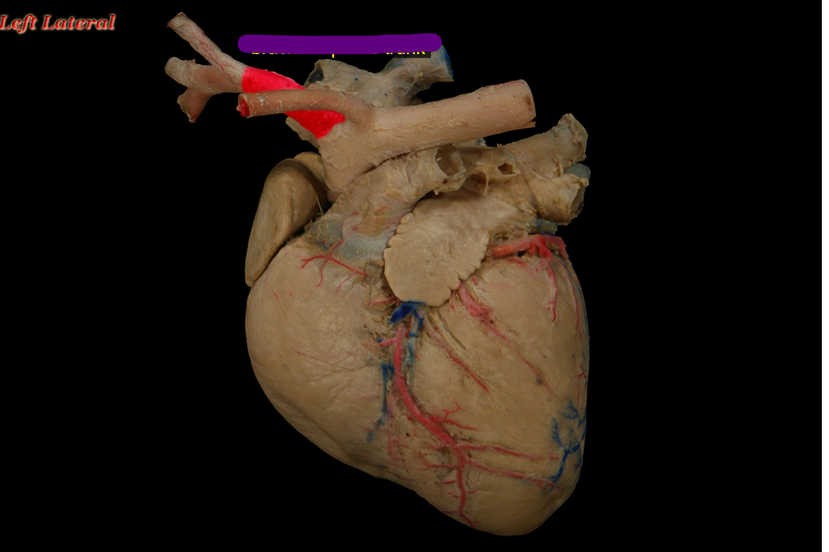 <p>name the structure </p>