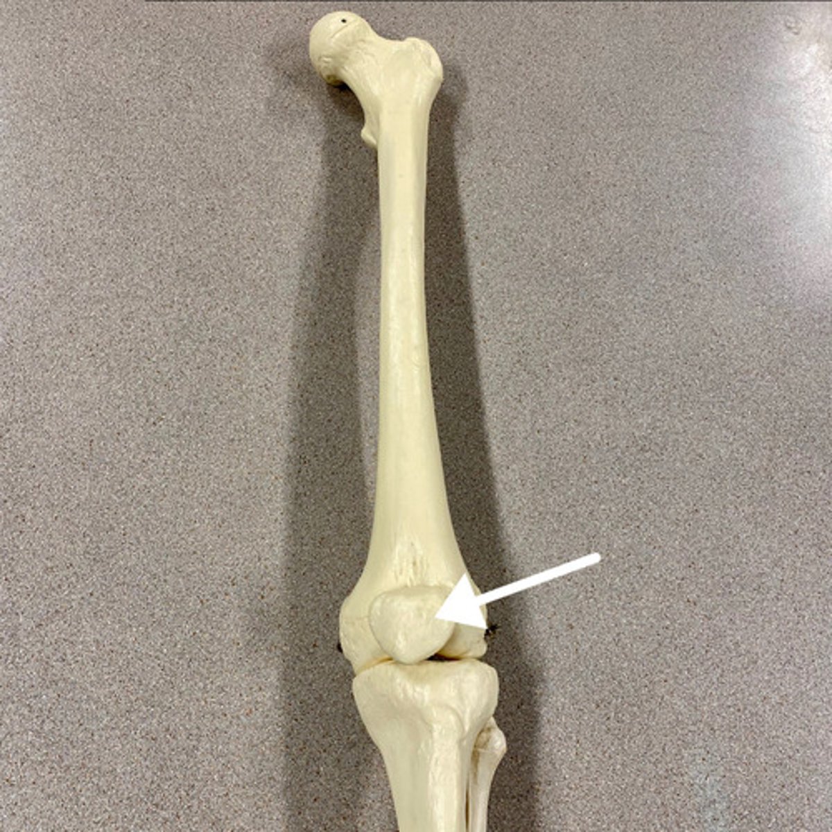 <p>What is this bone?</p>