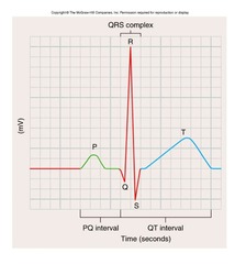 <p>What does the P wave represent?</p>