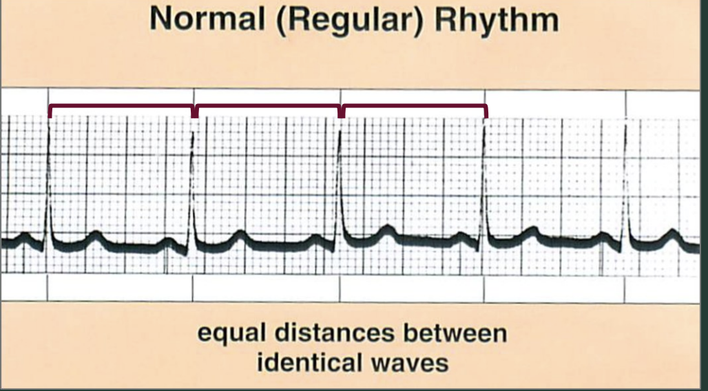 <p>What is NSR and what is the pace?</p>