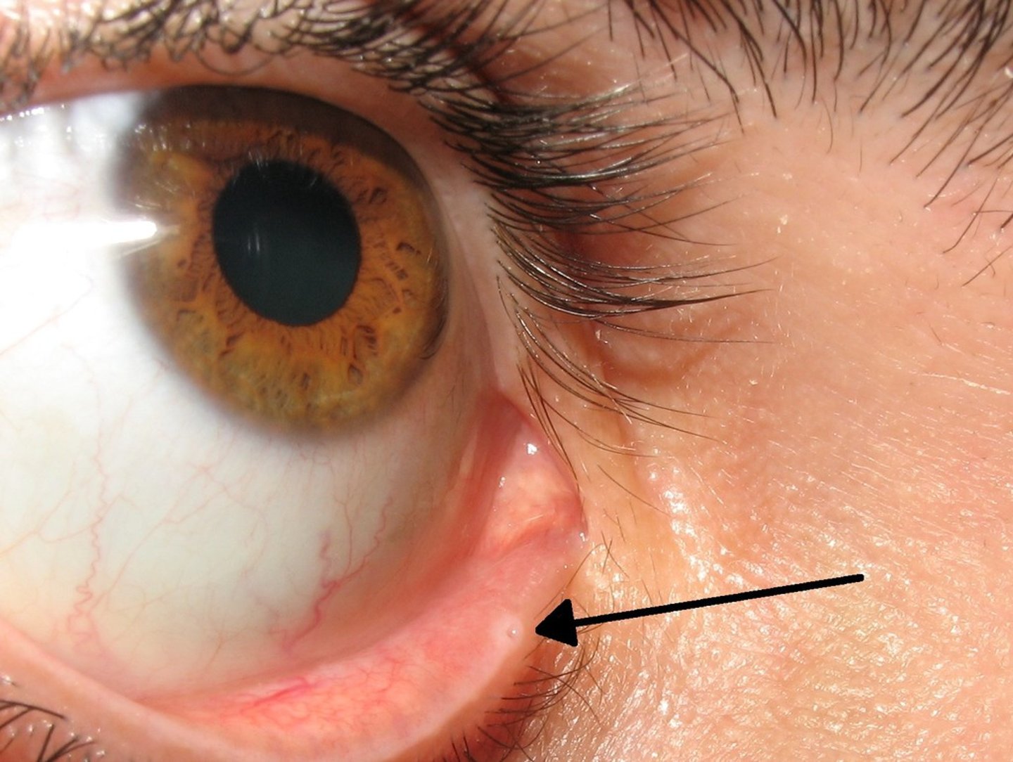 <p>-opening, drains fluid</p><p>-medial angle of eye, medial to caruncle</p>