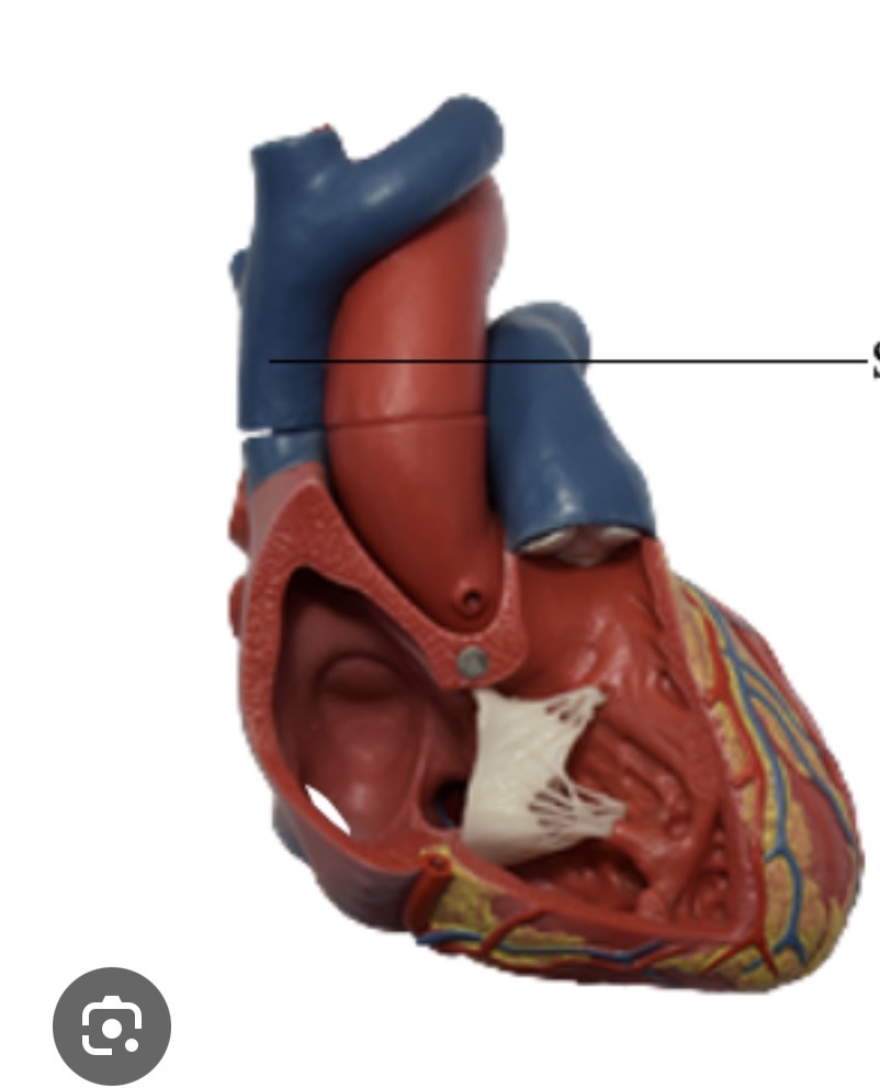 <p><span><span>on a heart model is the large vein entering the right atrium from above. It carries deoxygenated blood from the head, neck, upper limbs, and upper thorax into the heart. On most models, it’s positioned on the anterior/superior right side of the heart.</span></span></p>