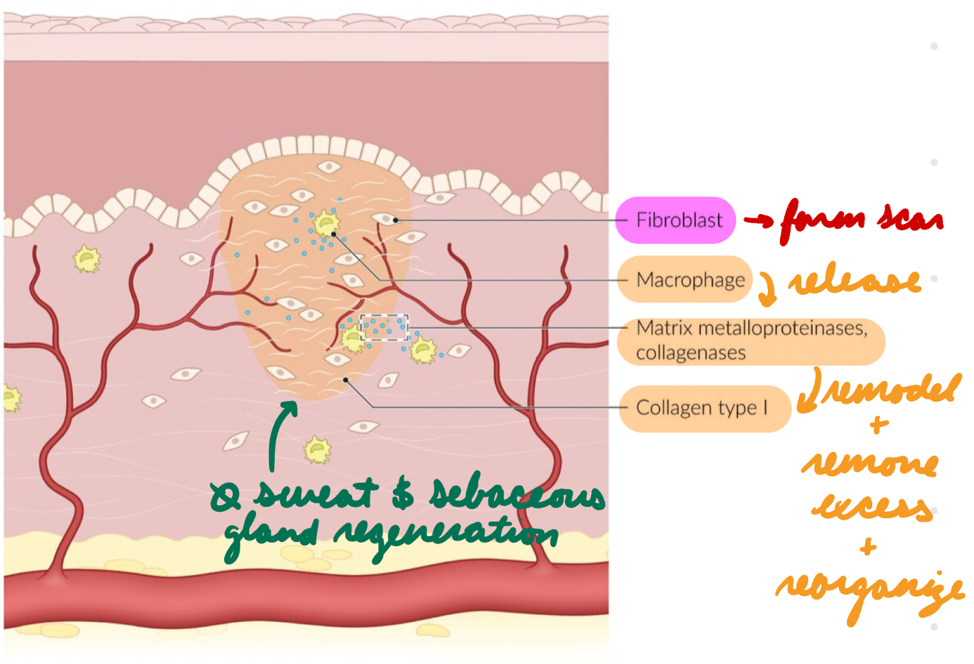 <p>Weeks to years</p><p>Fibroblast proliferation + connective tissue remodelling = Form scar</p><ul><li><p>Macrophages release metalloproteinases + collagenases = Remodel collagen</p></li><li><p>Remove excess collagen</p></li><li><p>Reorganize collagen = Increase injury strength</p></li></ul><p>No sweat + sebaceous gland regeneration</p>