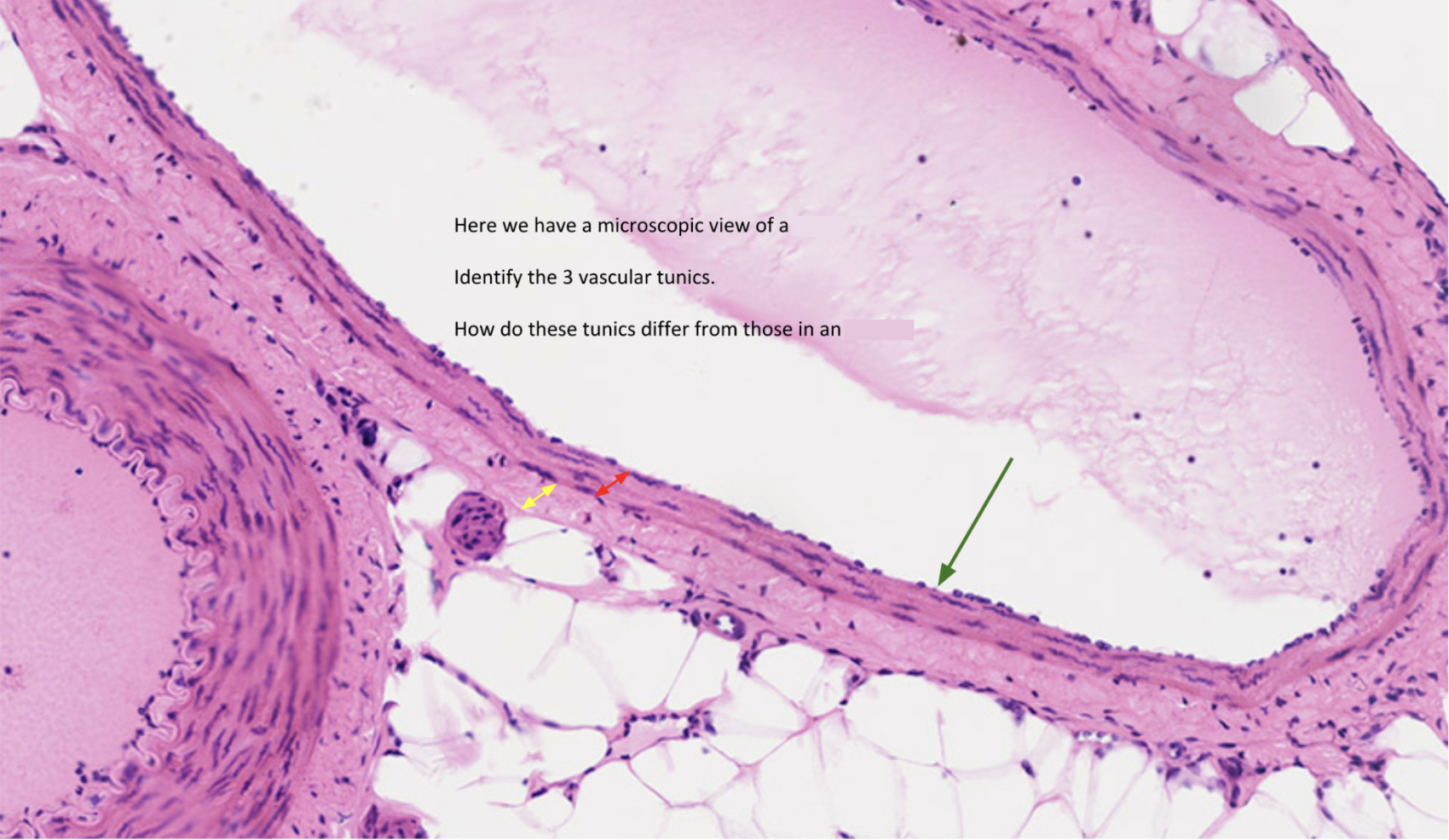<p>Is this a vein or an artery? Identify the layers labeled by the arrows</p>