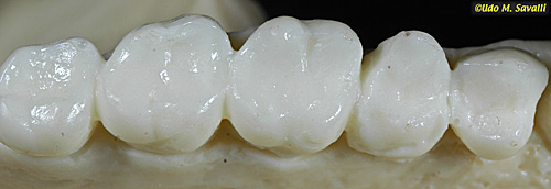 <p>Bunodont</p>