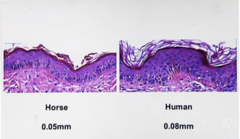 <p>Structure and thickness of skin vary based on what 3 main things?</p>